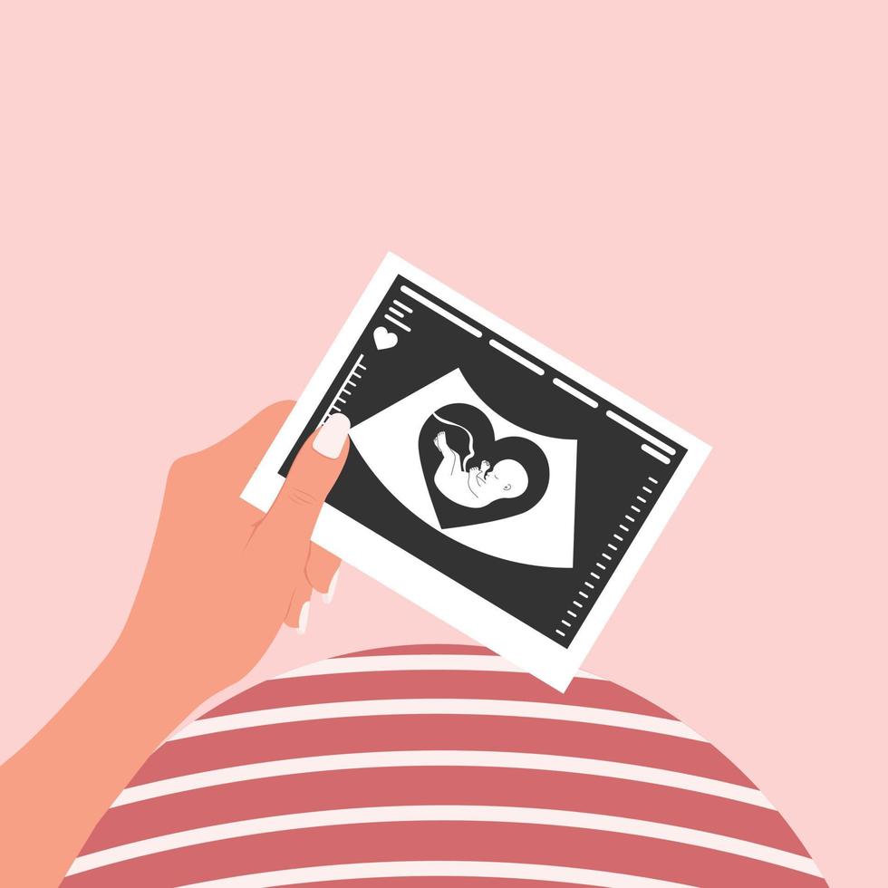 uma mulher grávida feliz segura uma foto de uma ultrassonografia fetal. uma imagem de ultra-som do bebê. vetor