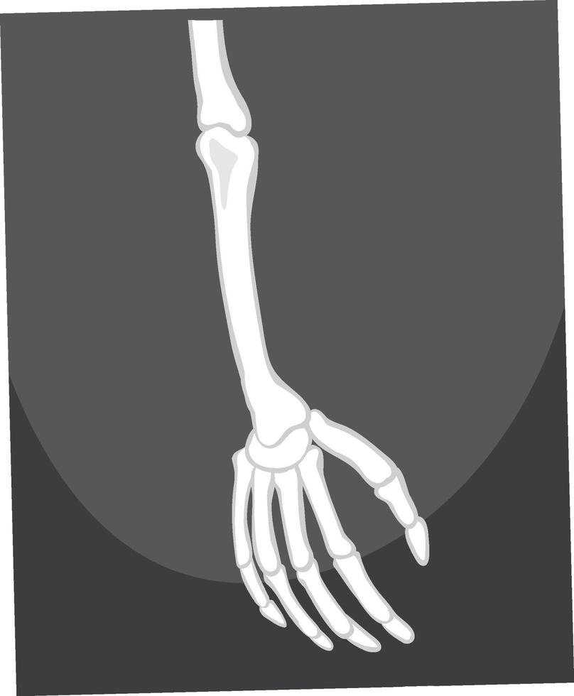esqueleto de braço e mão vetor