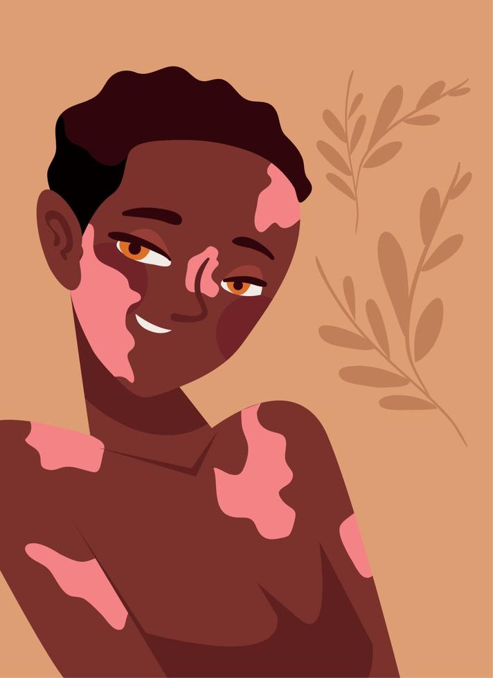 mulher afro com vitiligo vetor