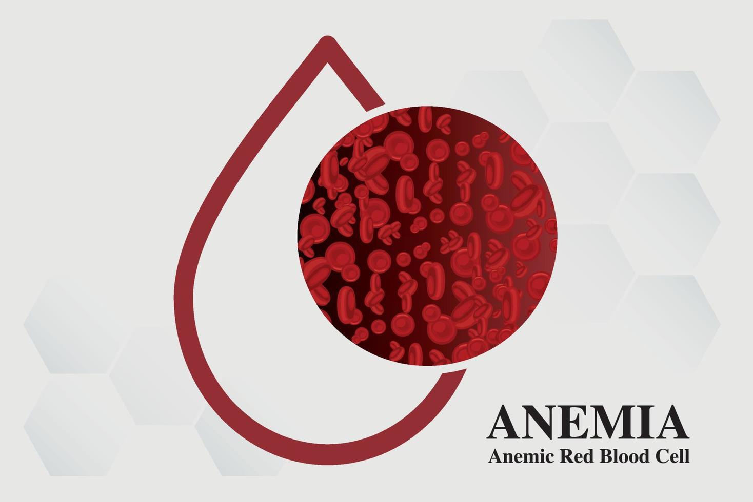 anemia ferro glóbulos vermelhos ilustração vetorial médica médica. vetor