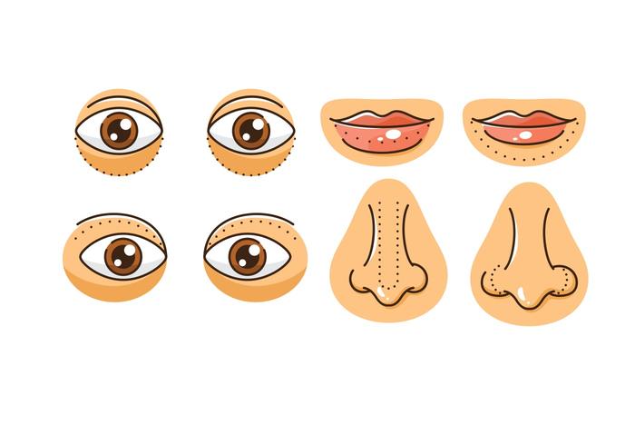 Ícones de cirurgia plástica vetor