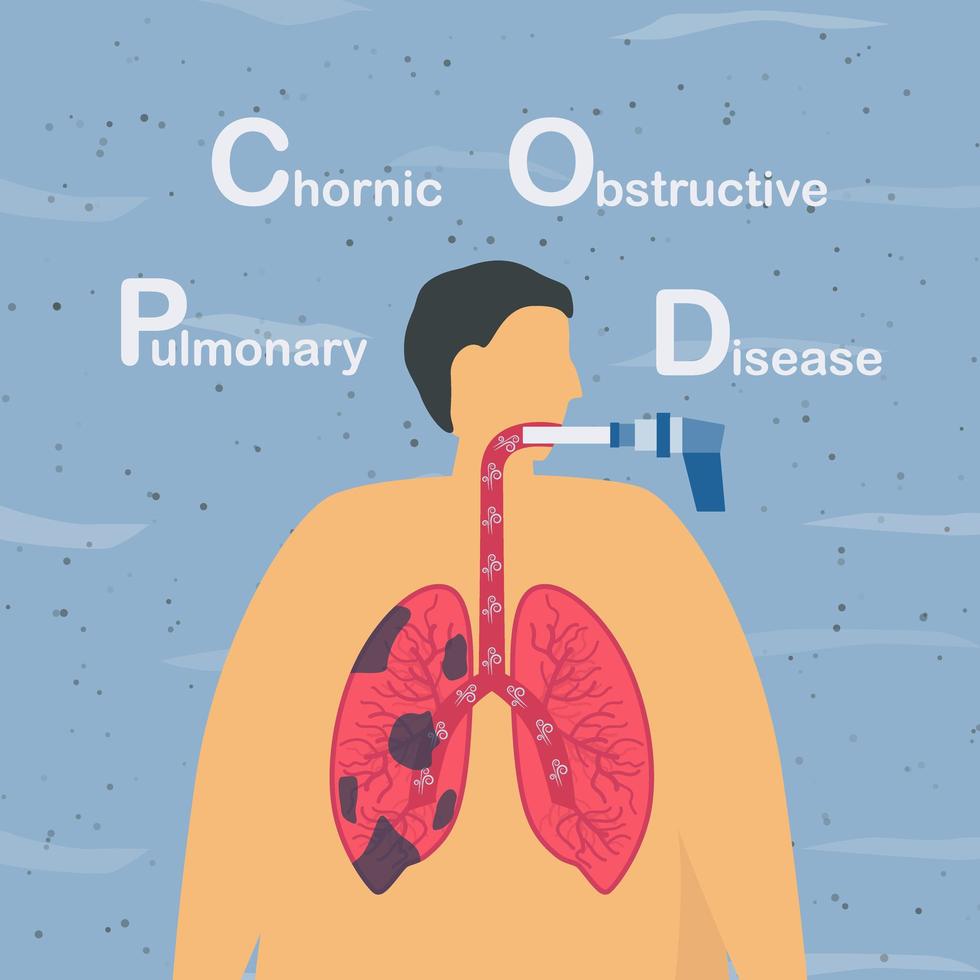 projeto de doença pulmonar obstrutiva crônica vetor