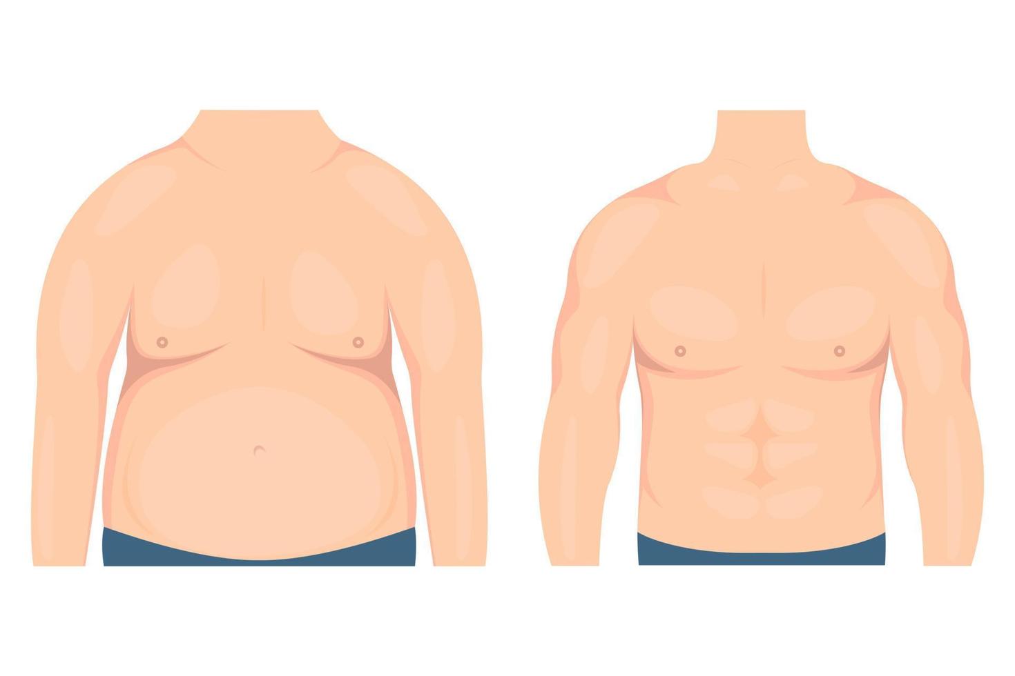 ilustração vetorial do torso de um homem antes e depois de perder peso e se exercitar. primeiro plano. para publicações médicas e publicidade de procedimentos cosméticos, plásticos vetor