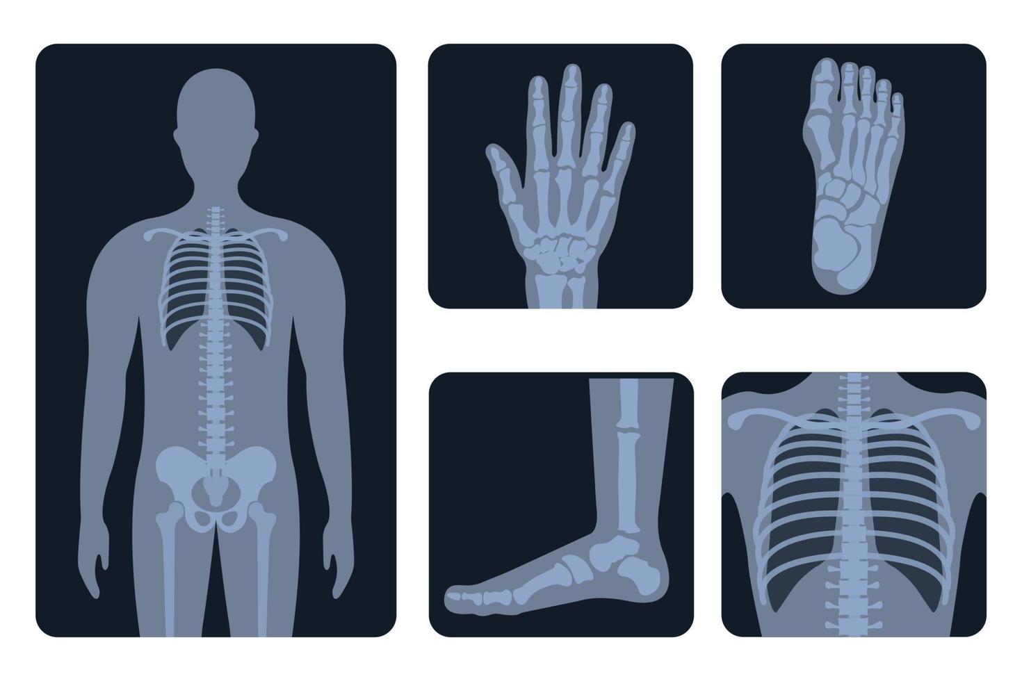 várias imagens de raios-x de partes do corpo humano vetor