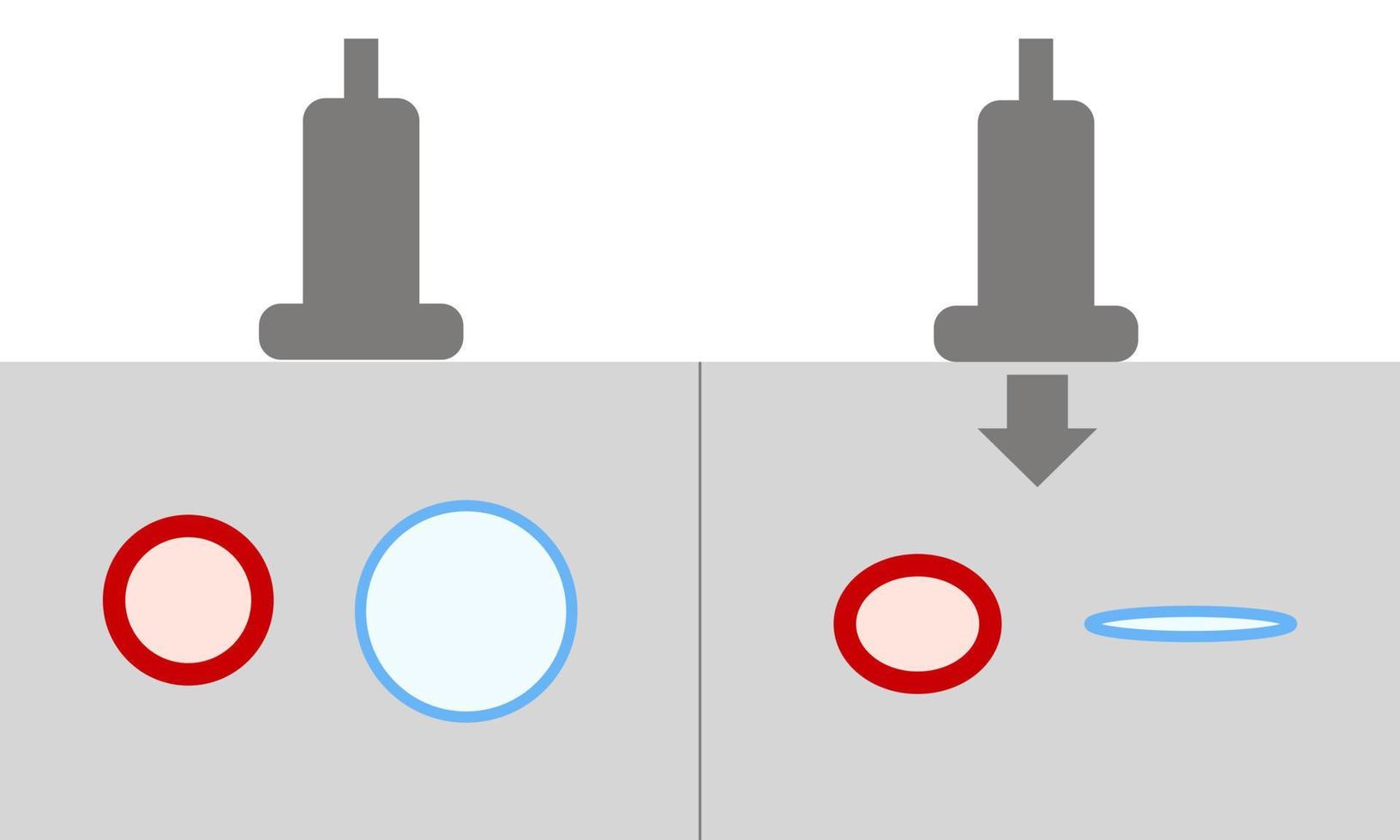 diagrama de ultrassom de compressão normal para diagnóstico de trombose venosa profunda vetor