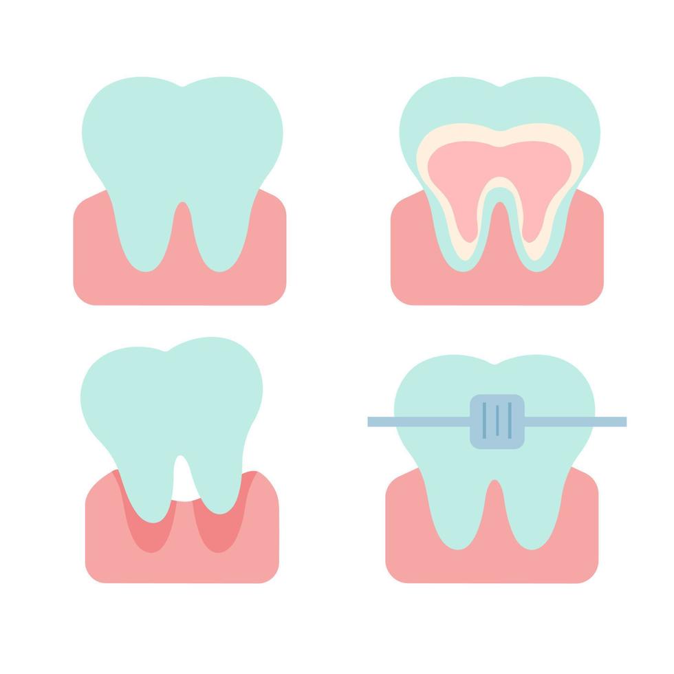 ilustração em vetor plana de dentes em diferentes estados.