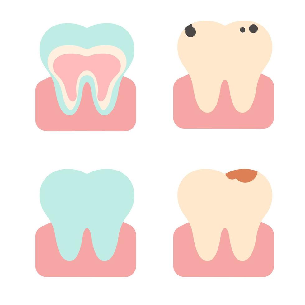 conjunto vetorial de dentes em diferentes estados. ilustração plana vetor