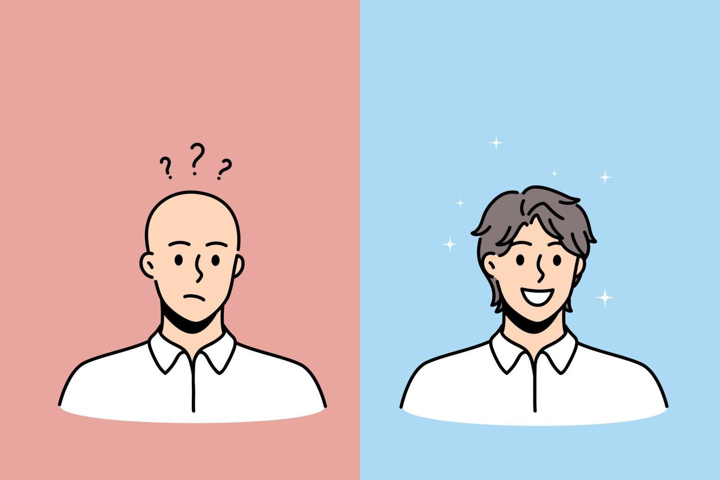 conceito de perda de cabelo e calvície. rostos de jovem completamente careca com humor frustrado e ilustração vetorial de pessoa peluda sorridente feliz vetor