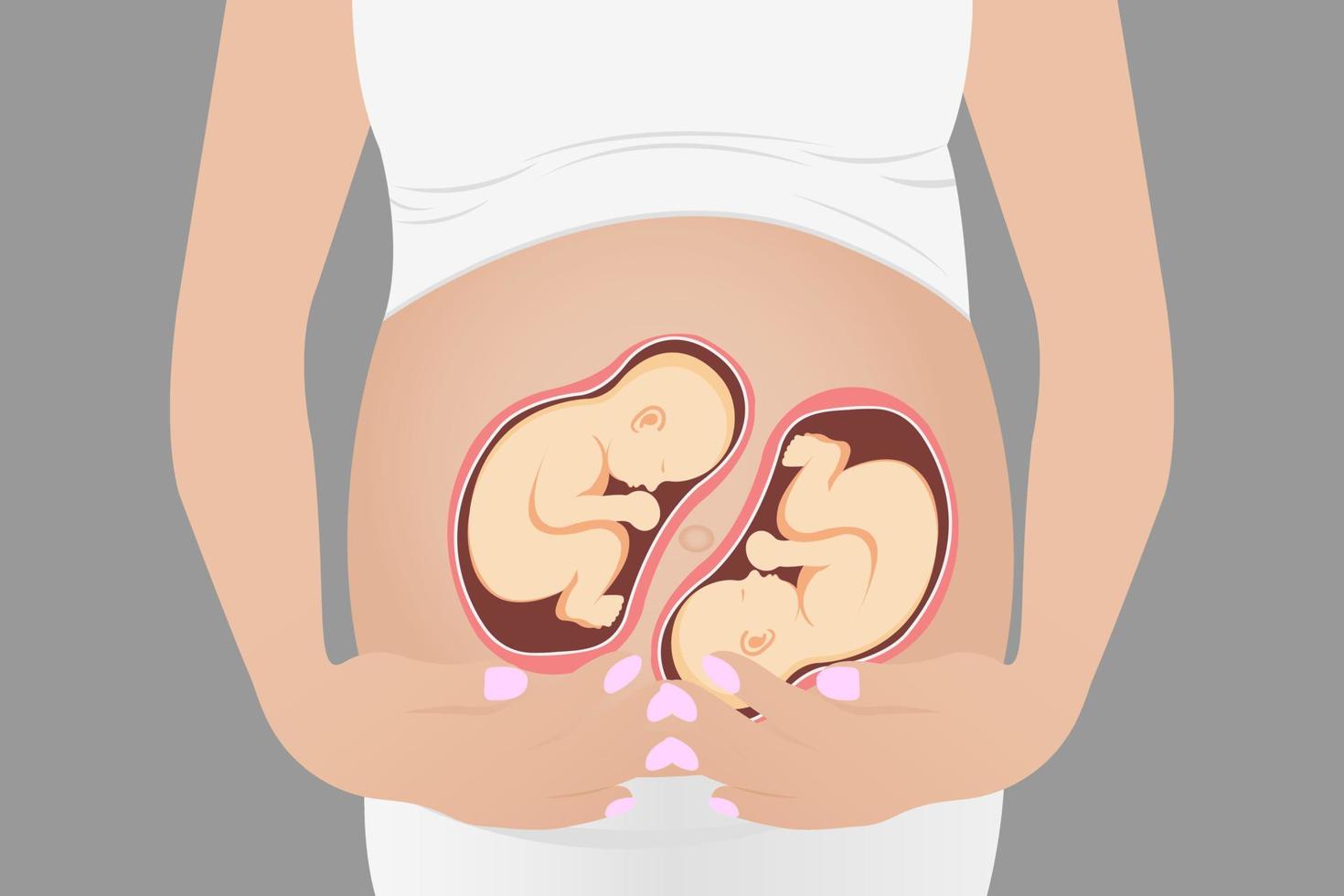 mulher grávida com gêmeos no útero. ilustração vetorial vetor