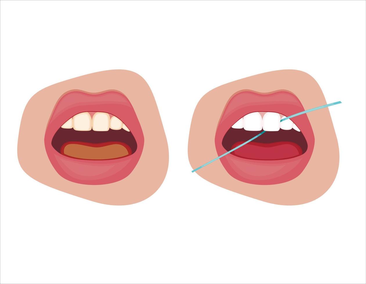 ilustração de agulha de dente, dentes saudáveis, ilustração vetorial de dentista, cuidados bucais vetor