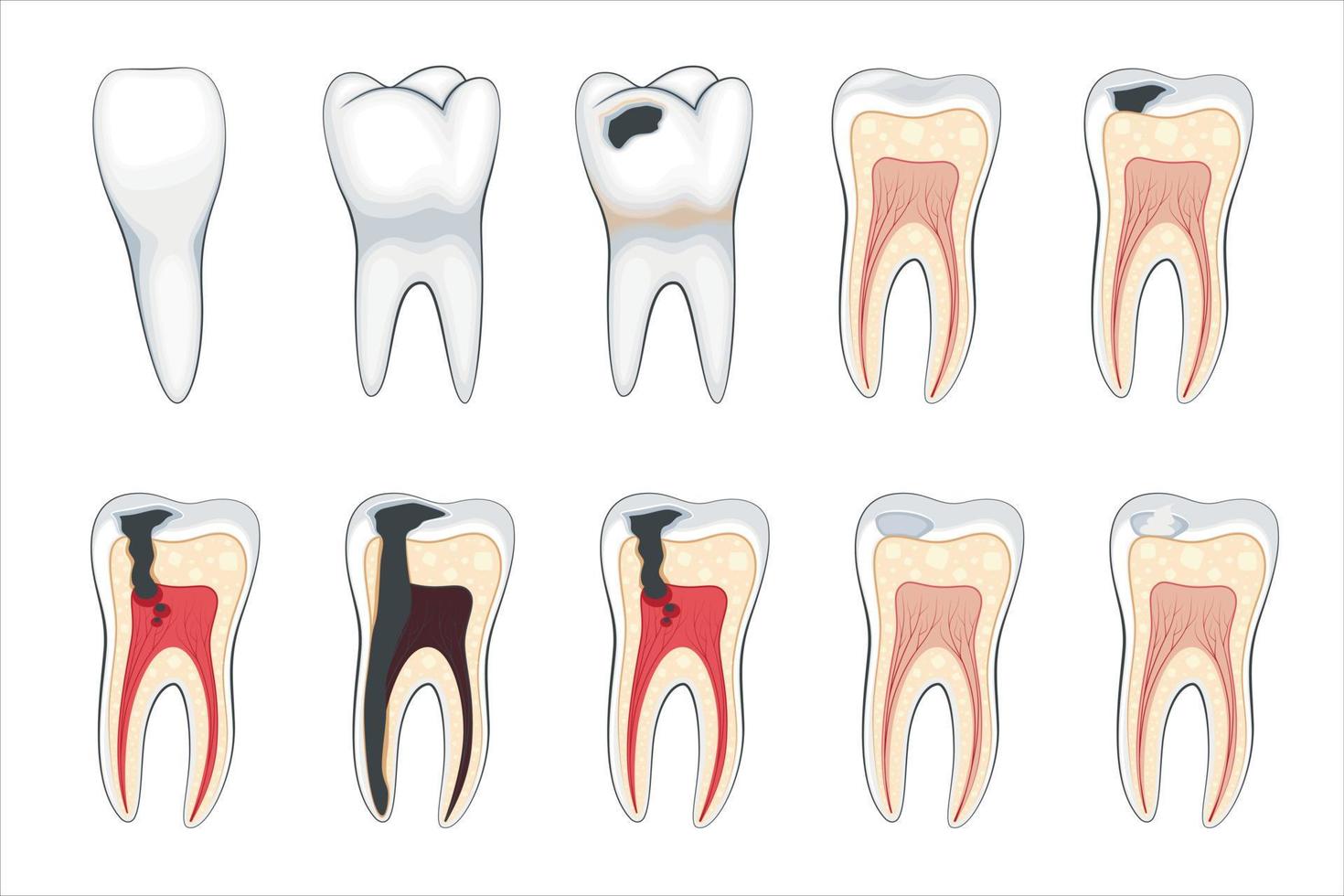ilustração de dente danificado, dentes danificados, ilustração vetorial de dentista, cuidados bucais vetor