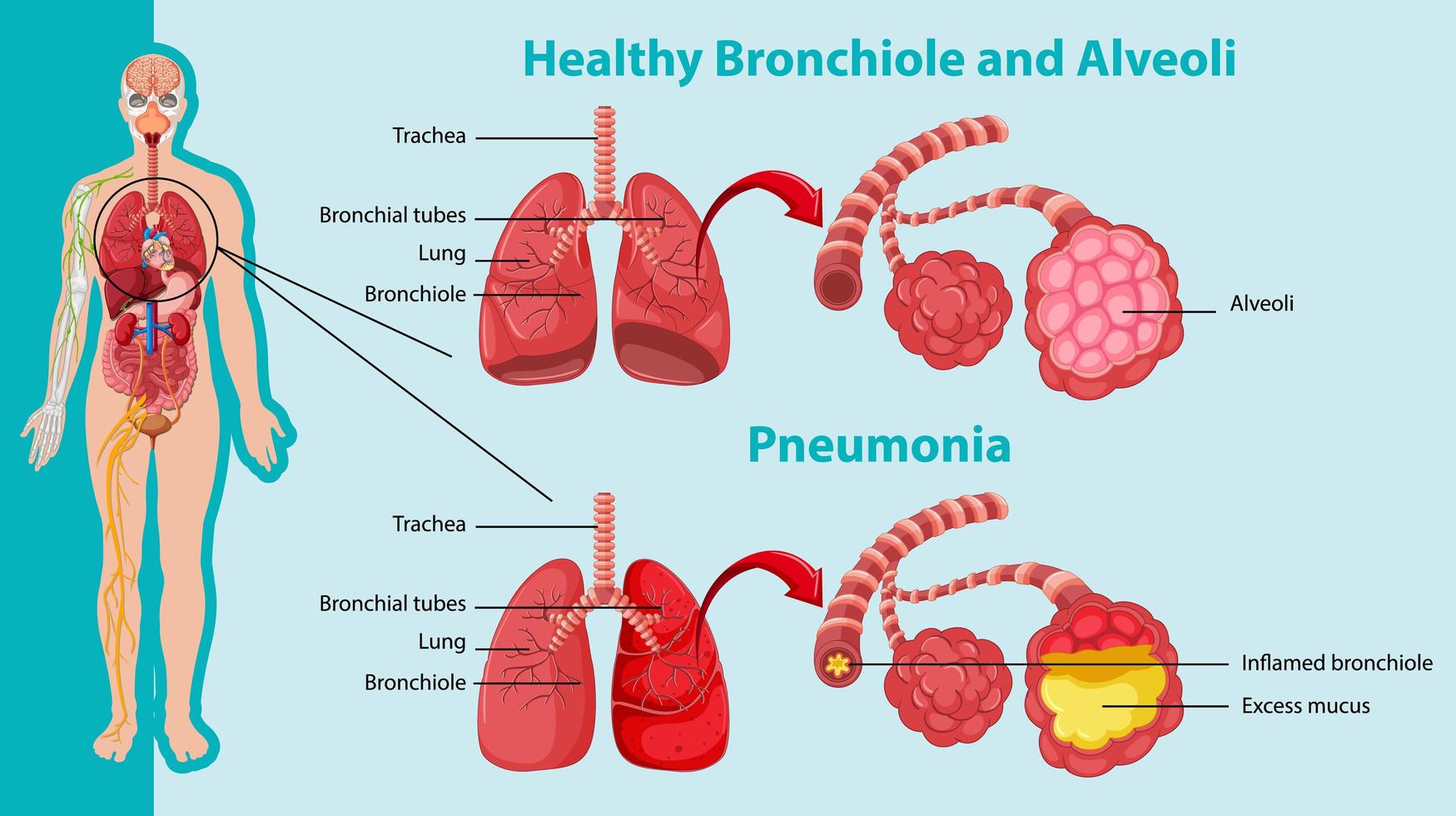 saudável e insalubre dos pulmões humanos vetor