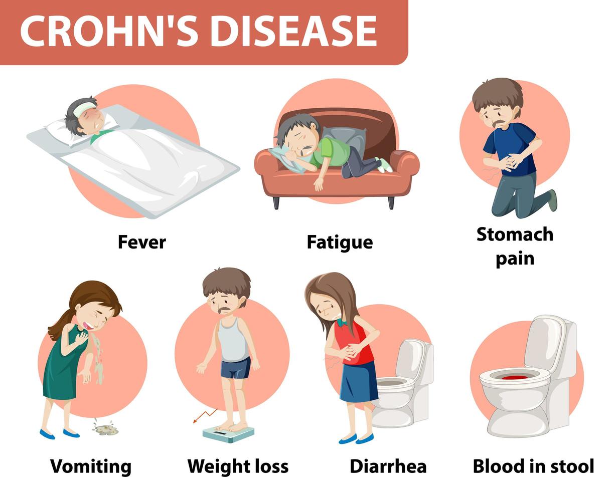infográfico médico da doença de crohn vetor