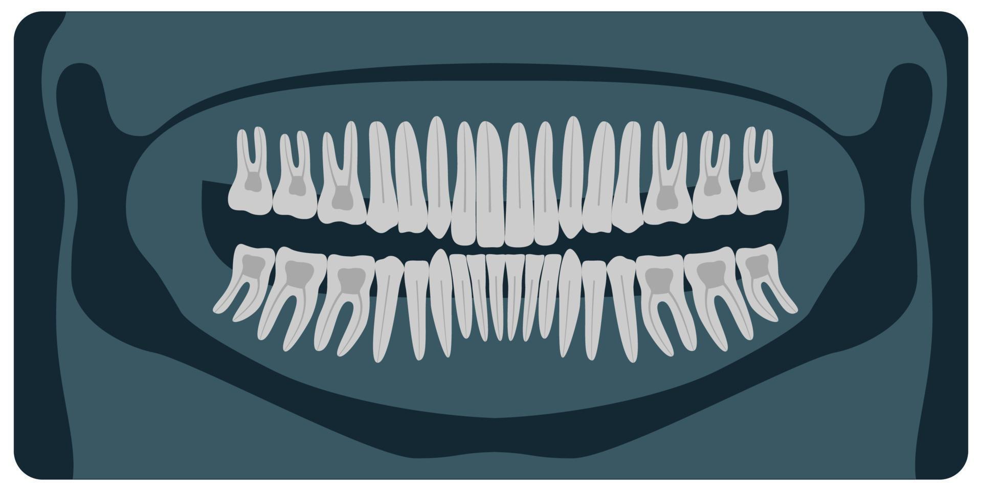 radiografia odontológica panorâmica. 32 dente saudável no raio-x. ilustração vetorial. vetor