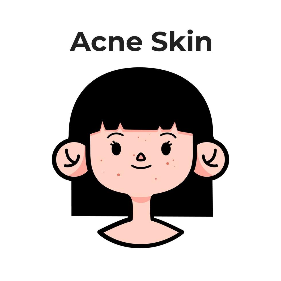 tipo de pele com acne vetor