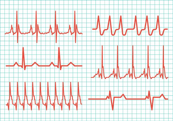 Ícones do vetor do ritmo cardíaco