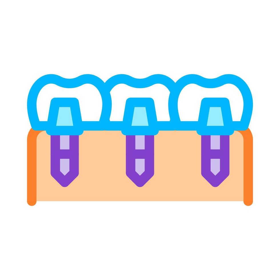 ícone de vetor de biomaterial de implantes dentários