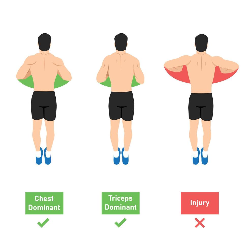 o músculo dominante push up. como fazer push up da vista superior. posição da mão. peito e tríceps ou lesão dominante. posição neutra e rotação interna. ilustração vetorial plana isolada em branco vetor