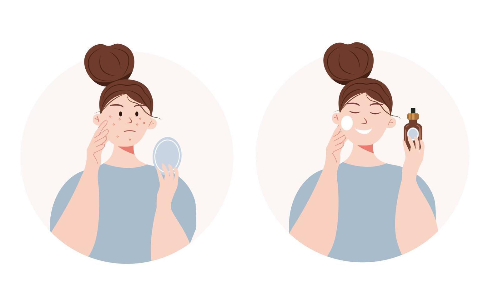 etapas de cuidados com a pele. ilustração dos desenhos animados com uma garota com acne usa problema de pele cosmética vetor