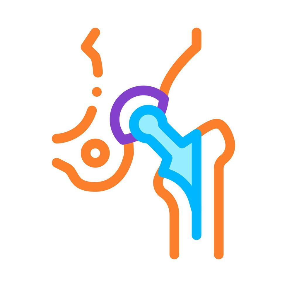 ícone de vetor de biomaterial de substituição de implante de quadril