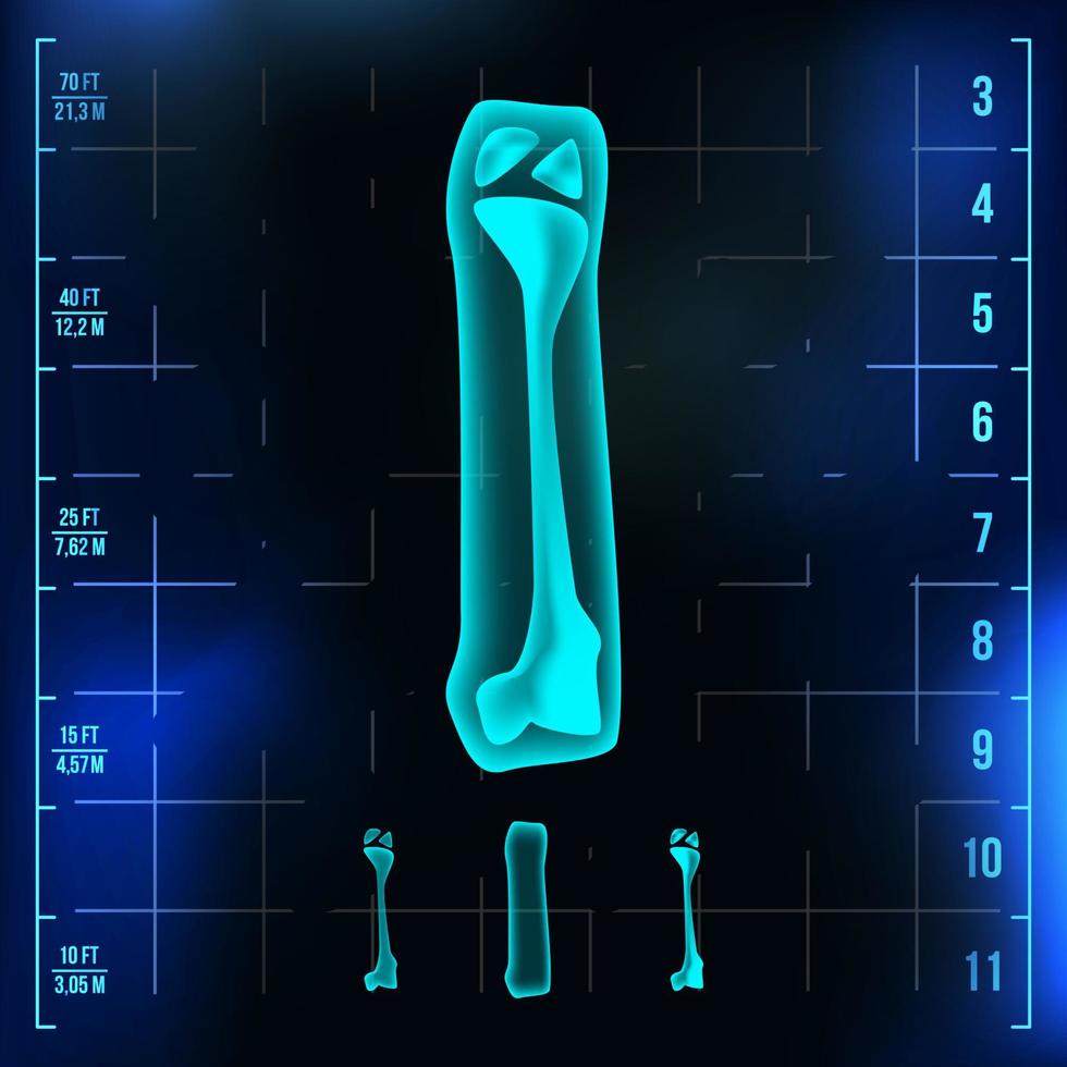 eu letra vetor. dígito maiúsculo. sinal de luz de fonte de raio-x roentgen. efeito de varredura de neon de radiologia médica. alfabeto. Dígito de luz azul 3D com osso. médica, hospitalar, pirata, futurista, vetor