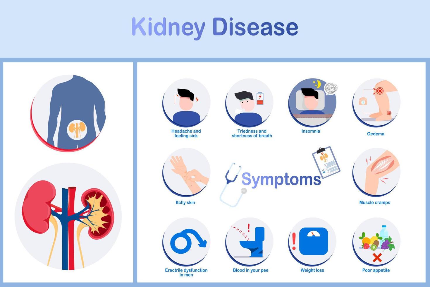 sintoma de doença renal, ilustração vetorial vetor