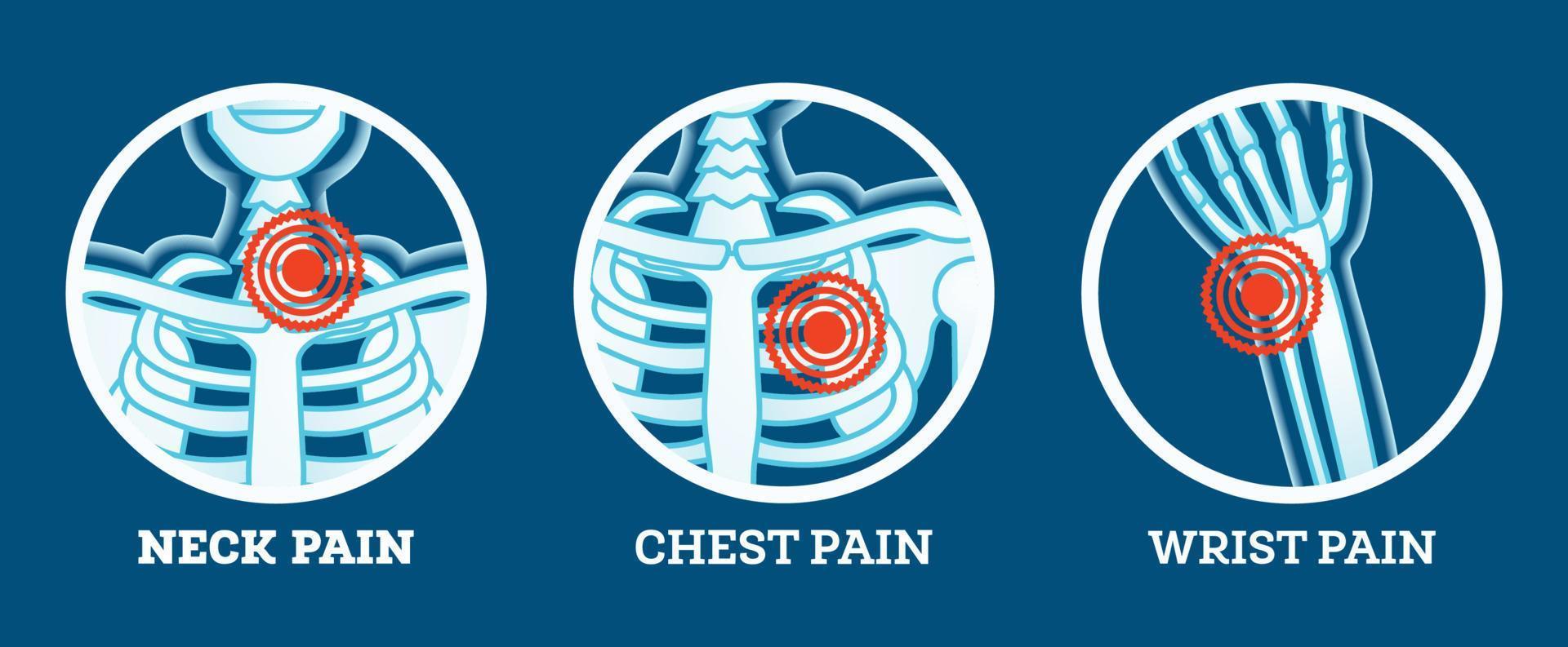 dor corporal. conjunto de ícones. dor no pescoço, tórax e punho. partes do corpo da mulher e do homem. vetor