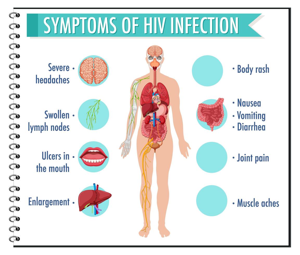 infográfico de sintomas de infecção pelo hiv vetor