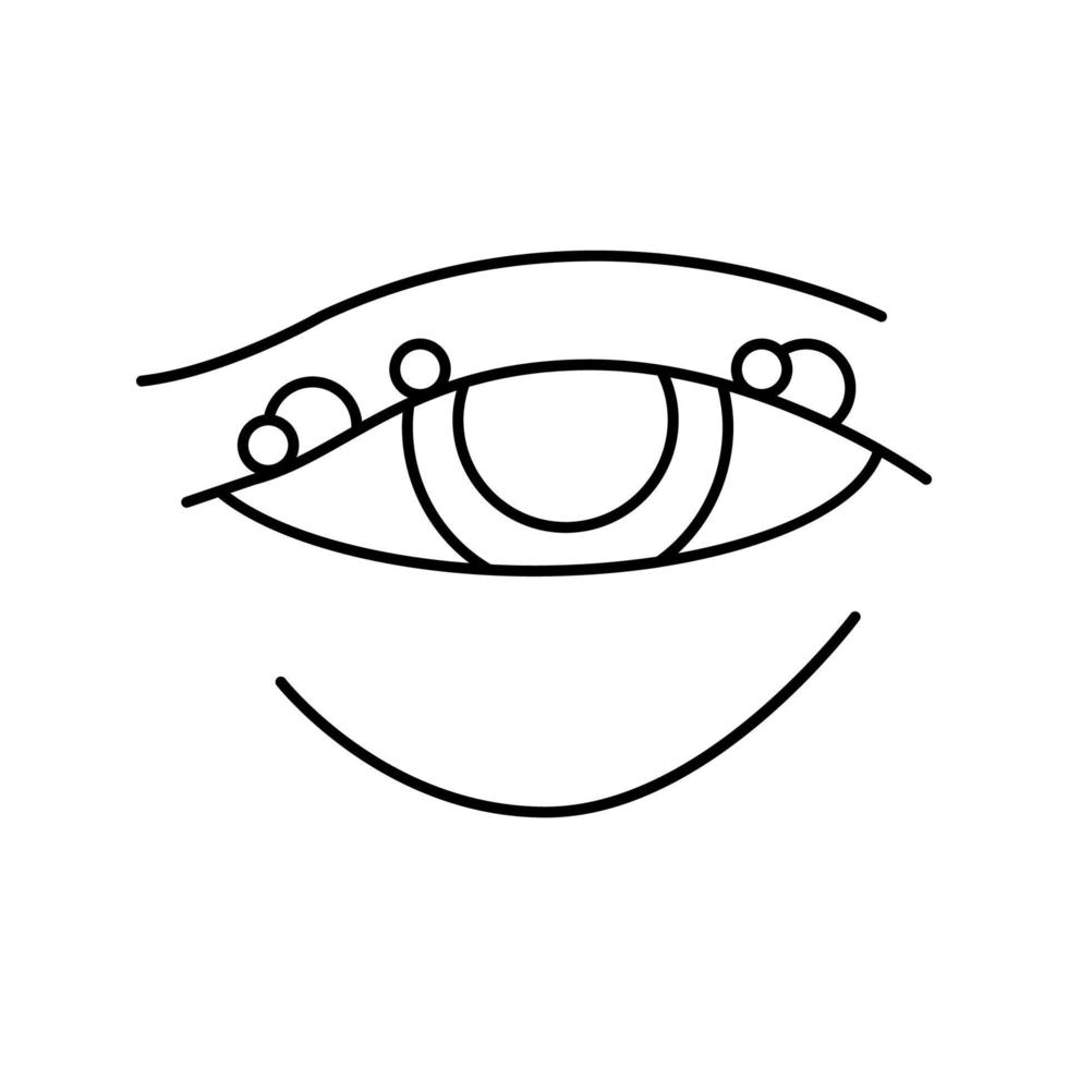 doença de blefarite, vermelhidão da ilustração vetorial de ícone de linha do globo ocular vetor