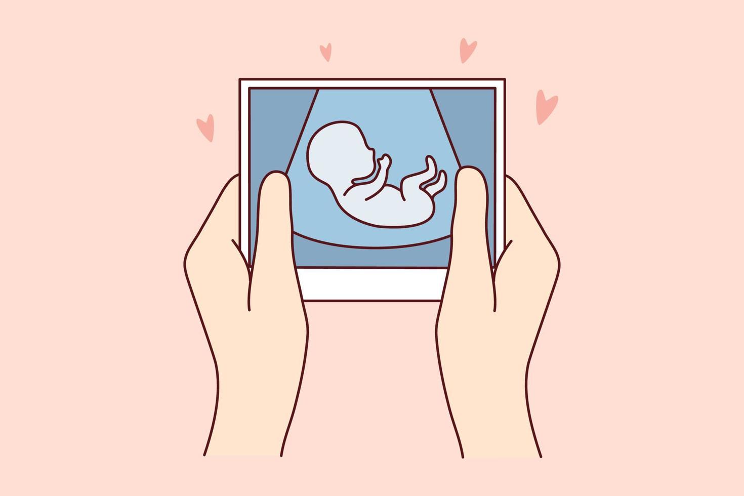 mãos da pessoa segurando a varredura do embrião esperando o nascimento do bebê. futura mãe com imagem de ultrassom do bebê. conceito de maternidade. ilustração vetorial. vetor