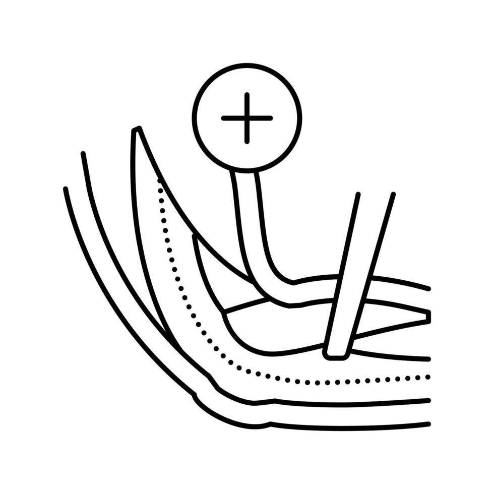 ilustração vetorial do ícone da linha de liberação do nervo ulnar vetor