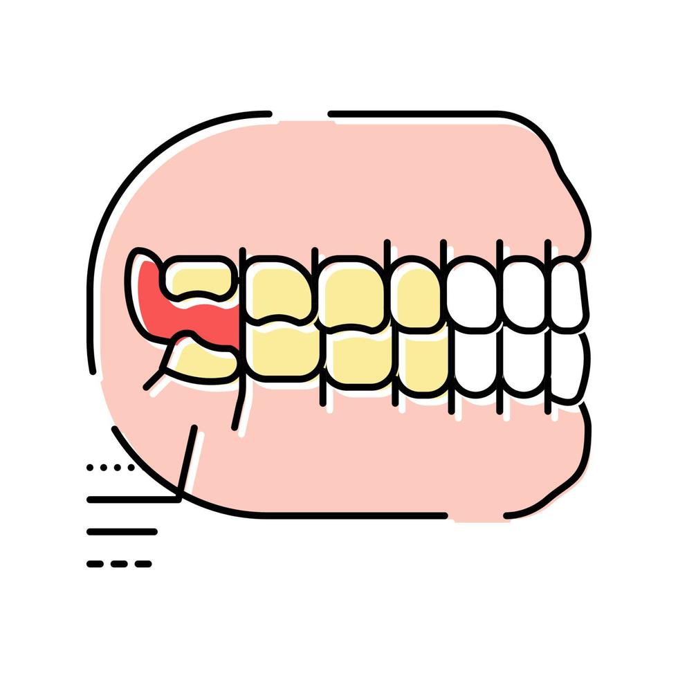 ilustração vetorial do ícone de cor do dente do siso vetor