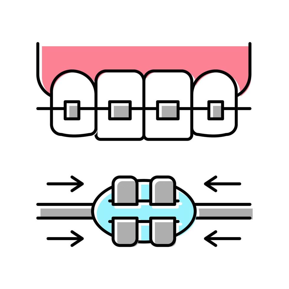 ilustração em vetor de ícone de cor de aparelho de dente de processo de trabalho