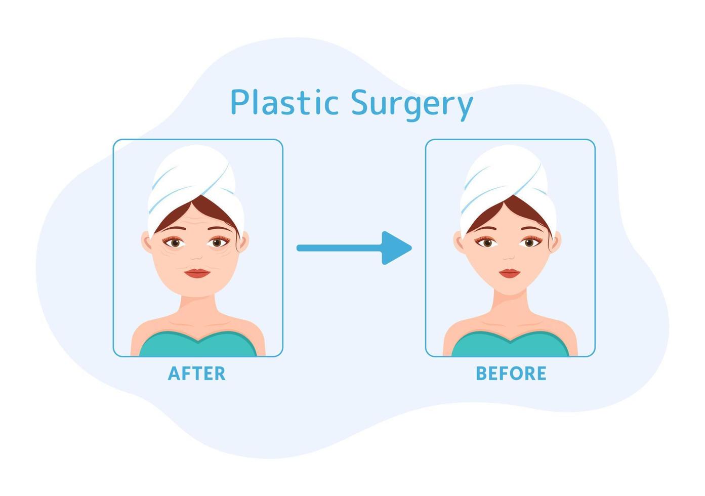 ilustração de modelos desenhados à mão de desenhos animados planos de cirurgia plástica de operação médica cirúrgica no corpo ou rosto como esperado usando equipamentos avançados vetor