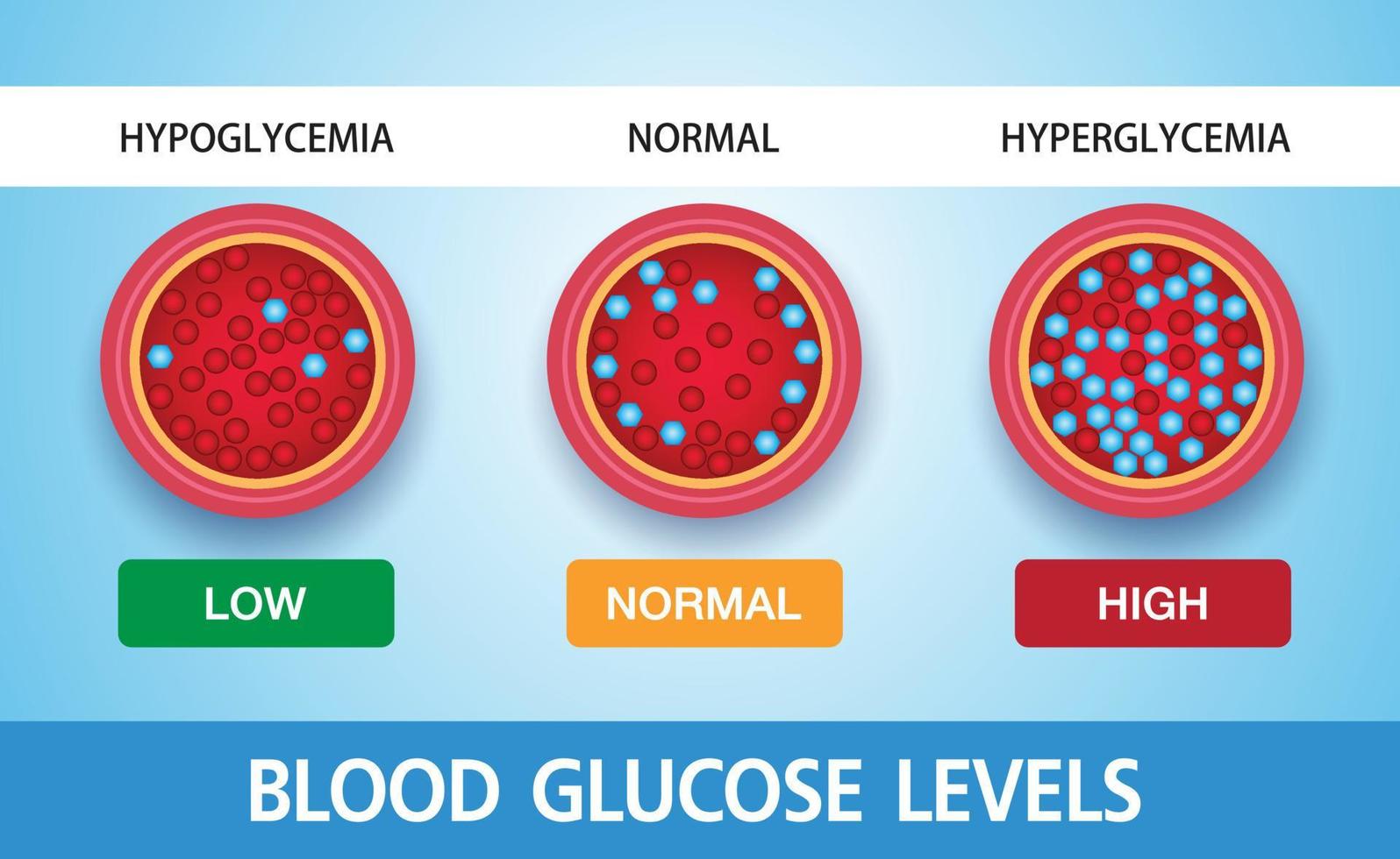 hiperglicemia, açúcar elevado no sangue e diabetes, a obesidade é uma causa grave de condição médica, design vetorial. vetor