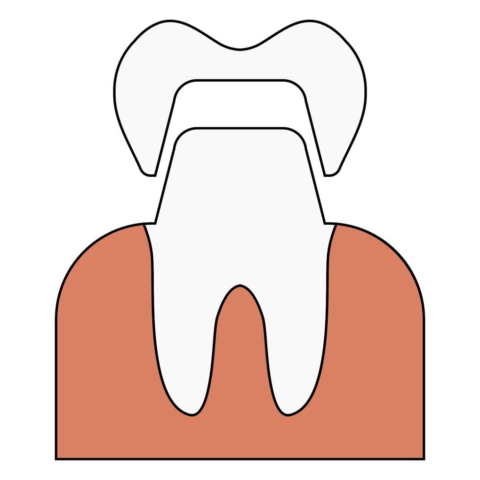 coroa dental dente, branco dentes, saúde médico, dentista coroa modelo vetor