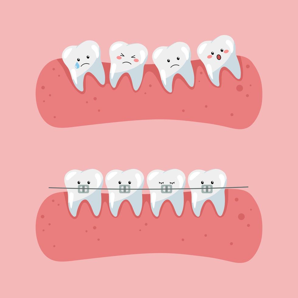 dentes com aparelho ortodôntico. arte em a tema do crianças odontologia. vetor
