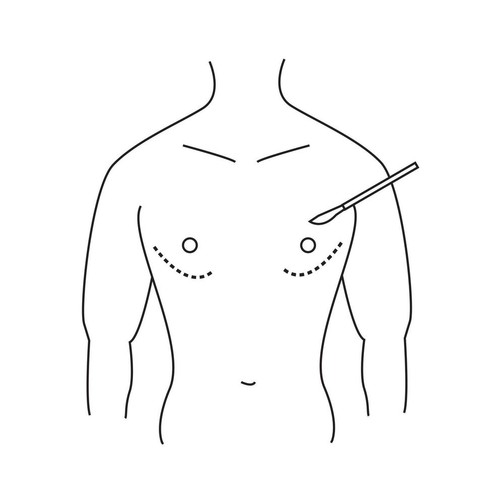 masculino seio cirurgia linha ícone. ginecomastia. masculino seio contornando. plástico cirurgia para homens. vetor