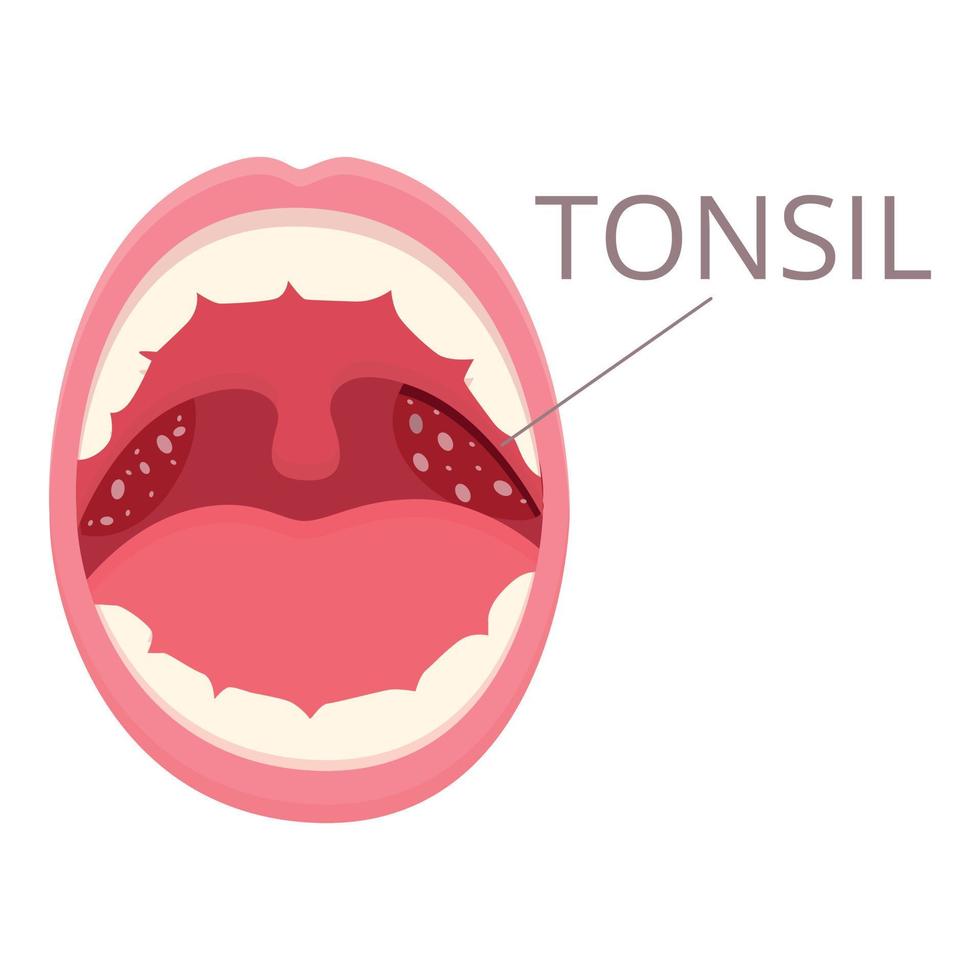boca amigdalite ícone desenho animado vetor. bacteriano higiene vetor