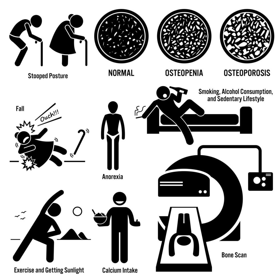 osteoporose, velho, mulher, sintomas, risco, prevenção, diagnóstico, stick figura, pictograma, icons. vetor