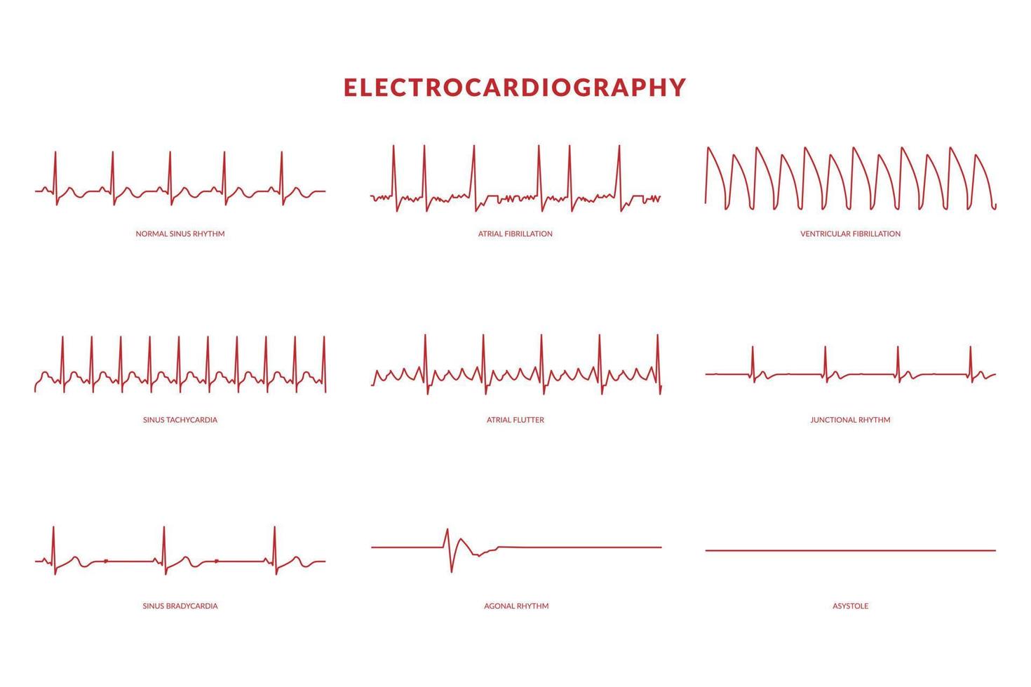 eletrocardiografia batimento cardiaco linha monitor. vetor eps10 ilustração