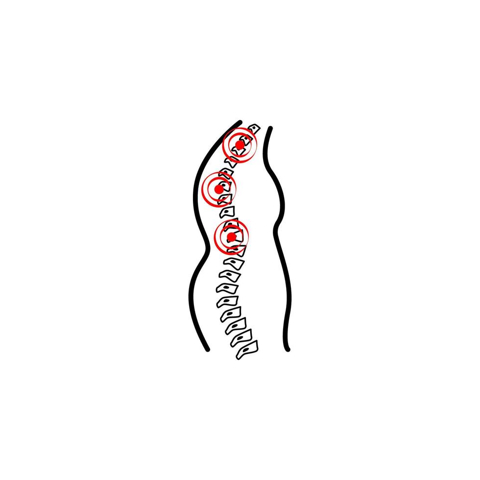 cifose, coluna vertebral , dor vetor ícone