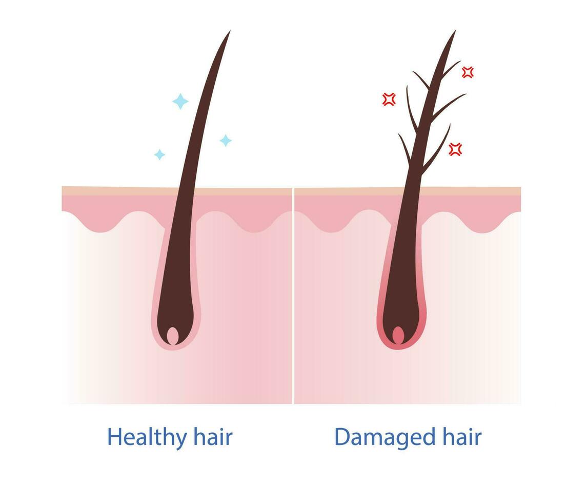 saudável cabelo e estragado cabelo com couro cabeludo camada vetor em branco fundo. cabelo Cuidado conceito ilustração.