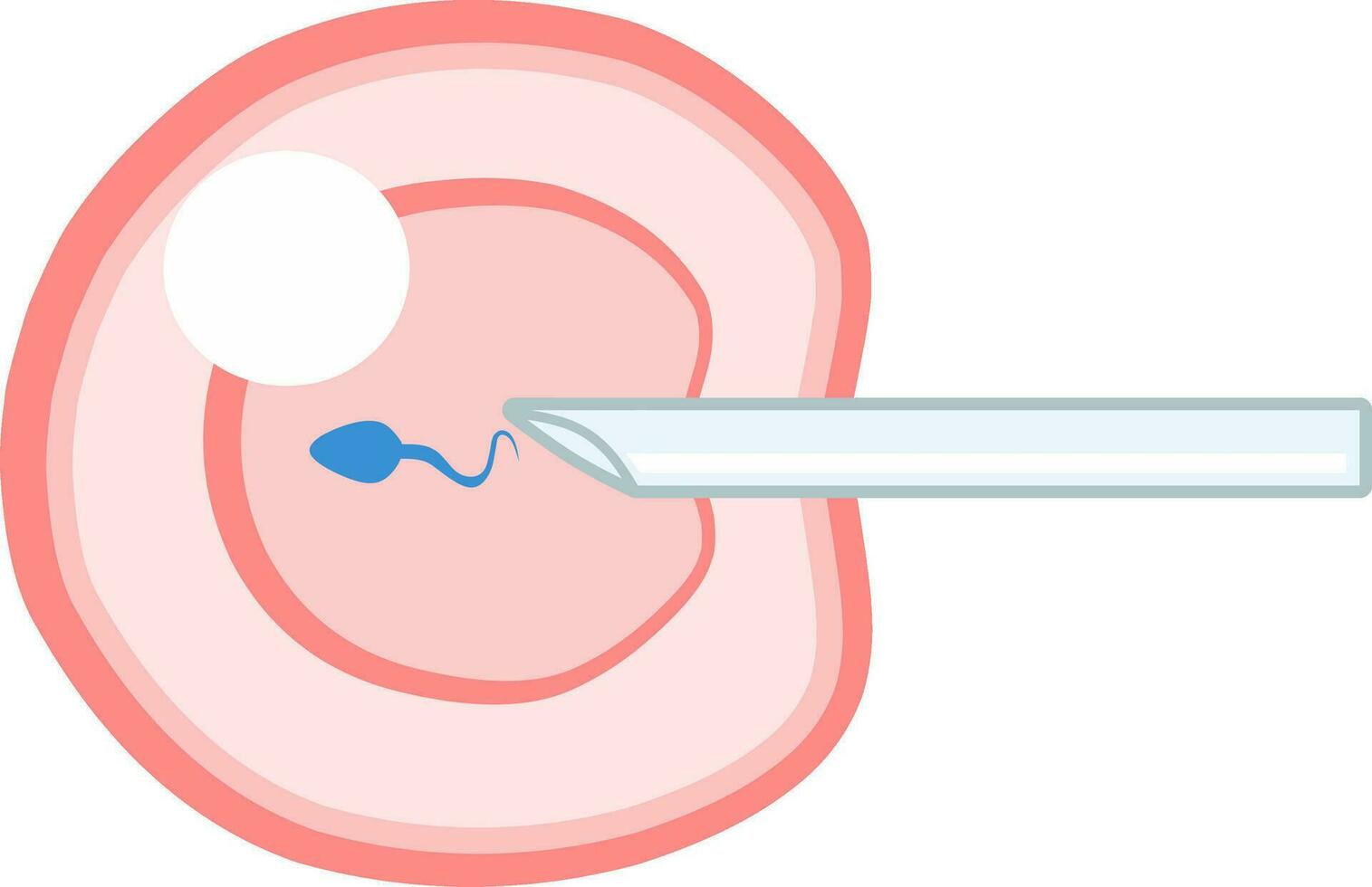 ivf icsi vetor ilustração. perfeito para apresentando qualquer coisa sobre reprodução, inseminação ou FIV.