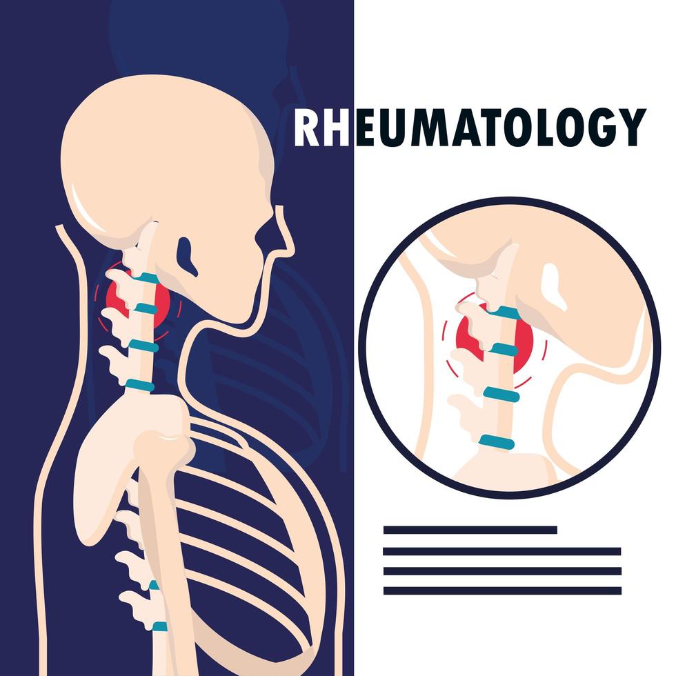 esqueleto humano reumatologia vetor