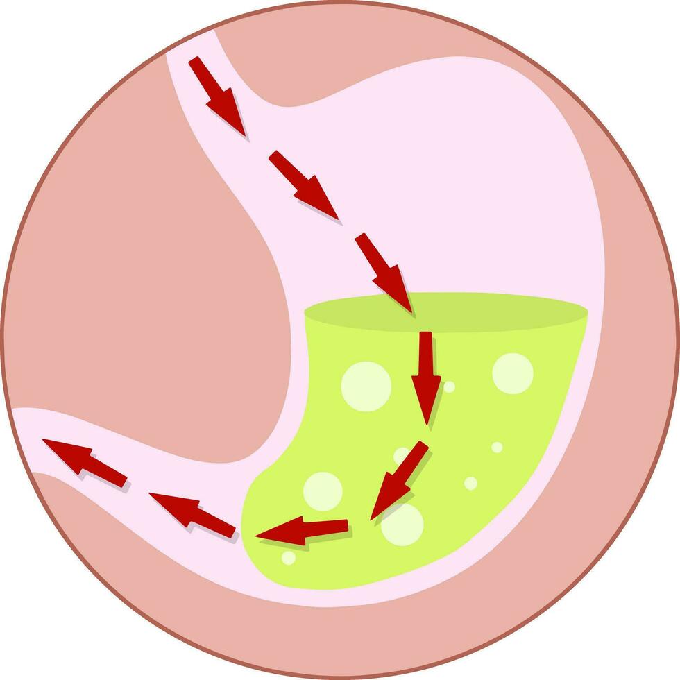 humano estômago. interno órgão do a corpo. Comida e remédio rota com vermelho direção seta. médico Cuidado. raio X do a barriga. digestivo problemas. desenho animado plano ilustração vetor