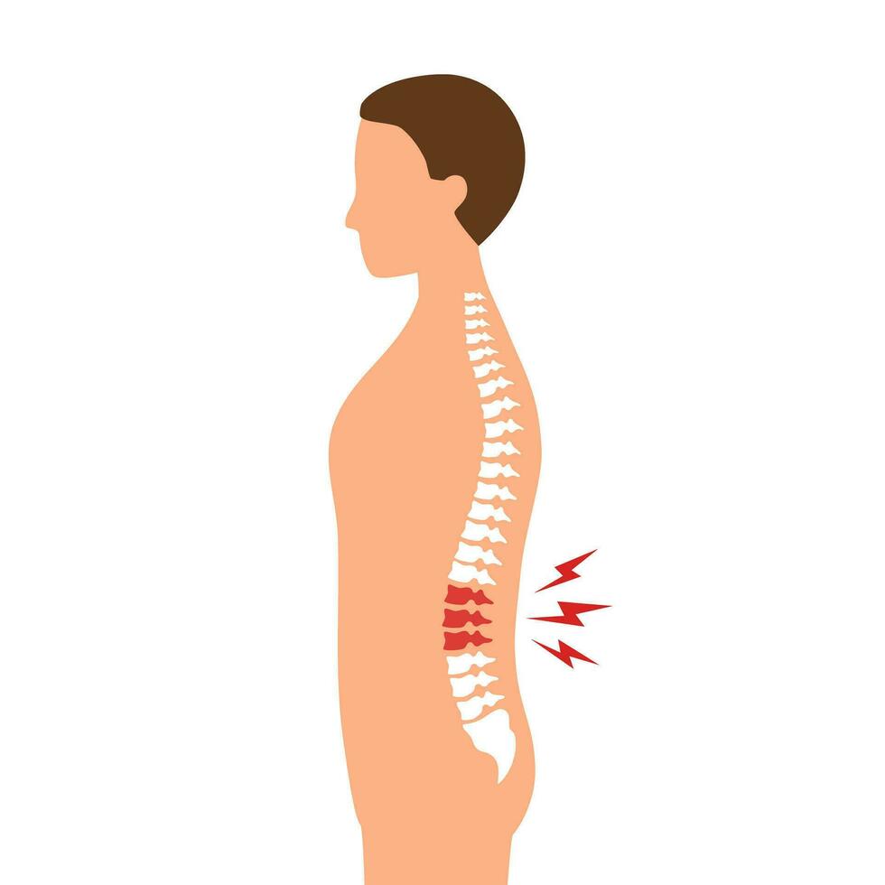homem com baixo costas dor sintoma dentro plano Projeto em branco fundo. vetor
