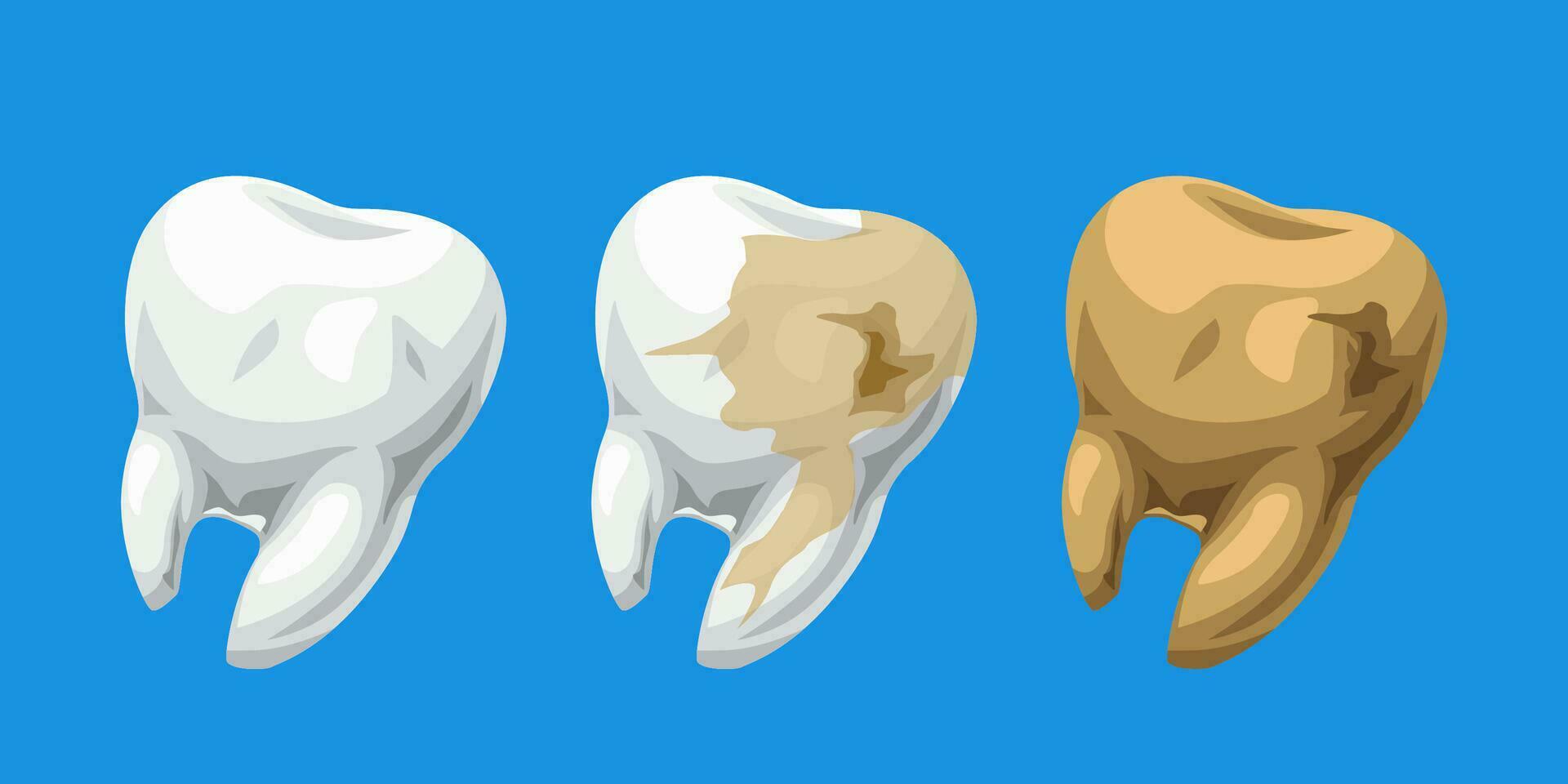 desenho animado dentes saudável e cárie vetor