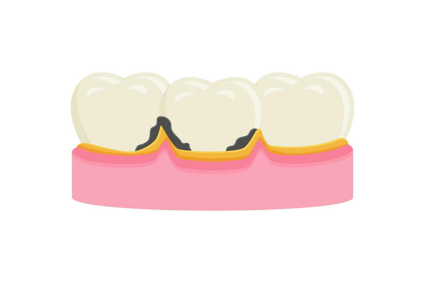 dental placa vetor ilustração. dor de dente ícone placa símbolo