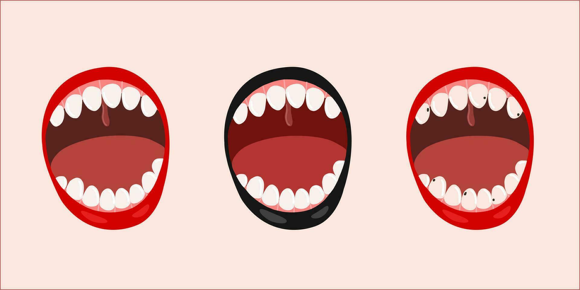 conjunto do aberto bocas com quebrado e saudável dentes, vetor plano ilustração